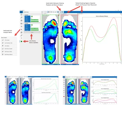 F-Scan™ GO - Système à semelles haute résolution sans fil