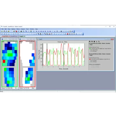 F-Scan64™ - Semelles connectées à 64 capteurs de pression