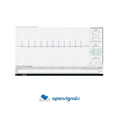 Variabilité de la fréquence cardiaque (VRC) pour OpenSignals (r)evolution