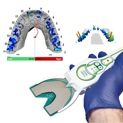 T-Scan® Novus™ - Mesure dynamique des contacts dentaires : forces, localisation, chronologie. Analyse occlusale numérique.